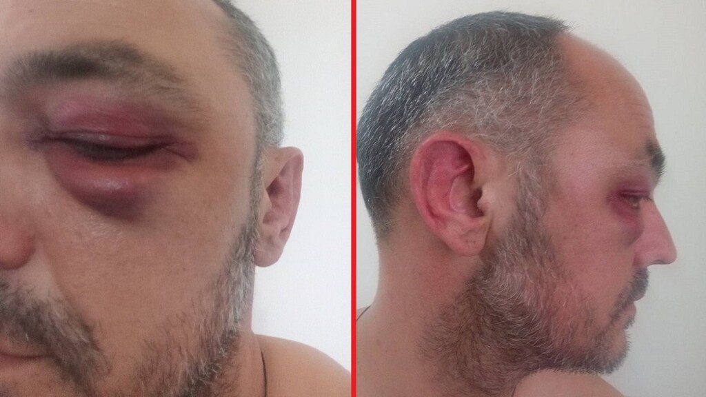 NASILJE U KAFIĆU „KRALJ“ U KOSTOLCU: Bojan Stefanović pretučen nakon rasprave o “dugovanju” (FOTO)